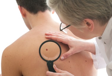 Ärztin untersucht ein Muttermal beim Patienten Ärztin untersucht ein Muttermal beim Patienten